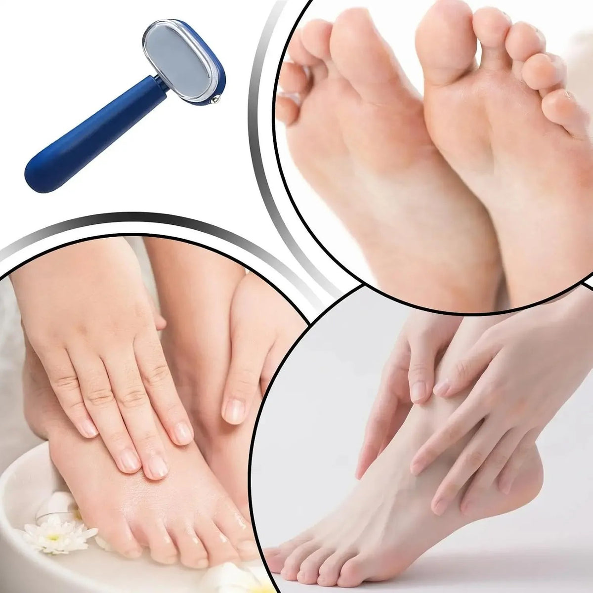 💅Dual-Sided Foot Callus Remover – Smooth, Soft Feet Without the Fuss