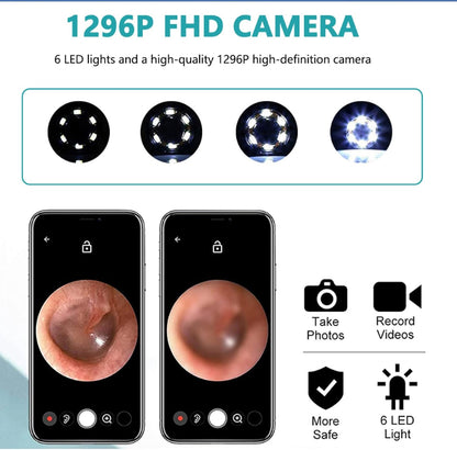 🔥🔥Give your ears a deep clean—don't overlook this! This visual ear pick is incredibly convenient, and it's half-price today.
