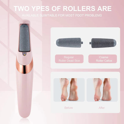 🌷 Hot Sale 50% OFF🌸-Electric Foot Exfoliator