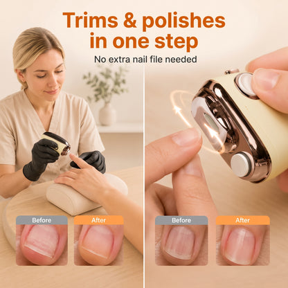 💥 Half-price offer! ✅ Electric safety nail clipper—trims and smooths simultaneously.