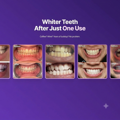 Purple Teeth Whitening Strips for Sensitive Teeth, Enamel Safe Whitening Strips to Remove Coffee Wine Smoking Stains, Non Slip Teeth Whitening Kit with Low Sensitivity Formula ！