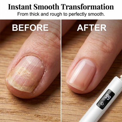 🔥Monthly sales of 100,000+, limited-time 50% off offer✨Super long battery life, low noise professional electric nail polisher, nail file, cuticle remover, and buffing machine.