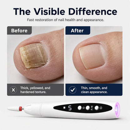 💅✨ 2-in-1 Electric Nail Drill with UV Lamp💖🔋