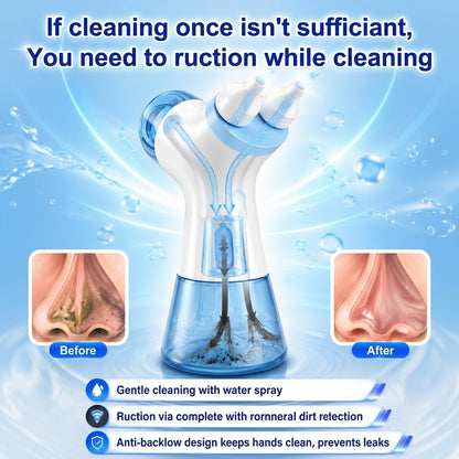 ✨ Electric Positive & Negative Pressure Nasal Irrigator, Professional Nasal Rinsing Device for Nasal Cavity Care